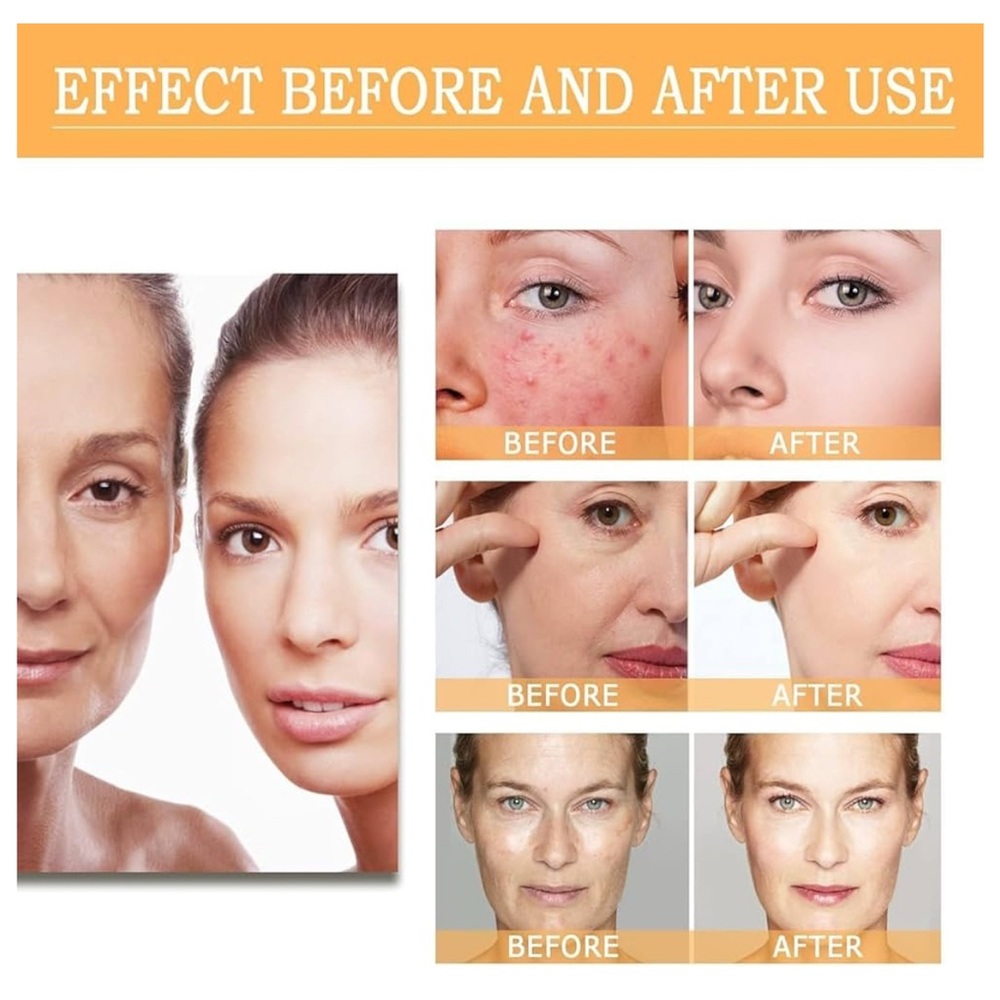 Glycolic Acid Toning Solution, Glycolic Acid 7% Toner, Glycolic Sour 2 for 35